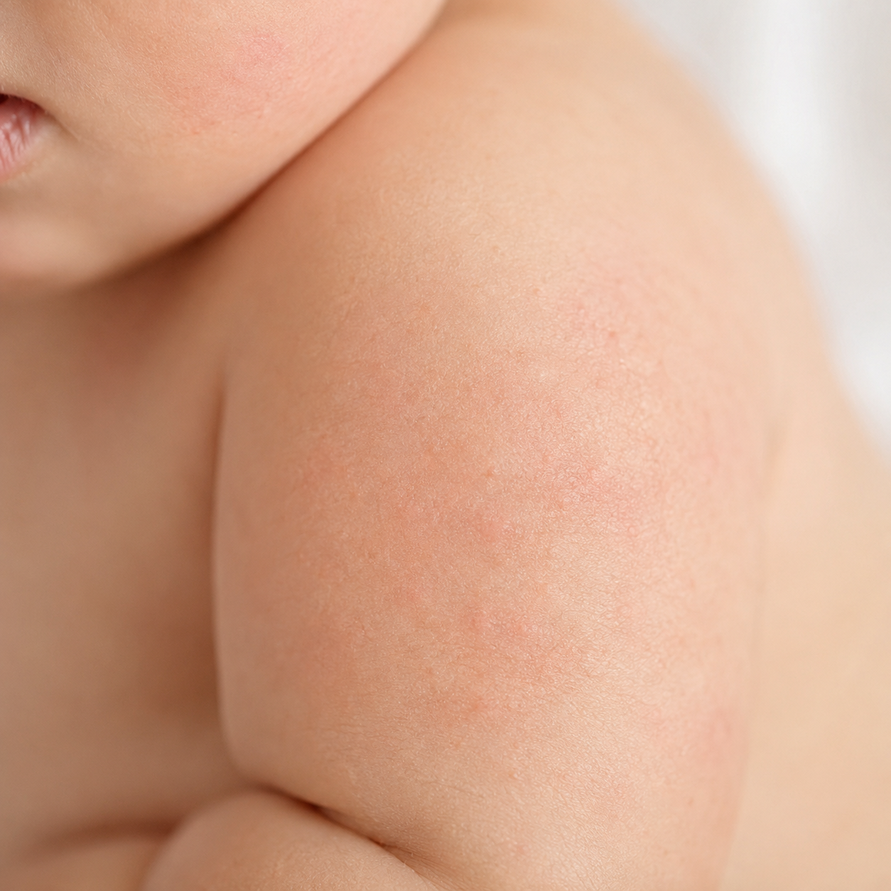 Peau sensible de bébé : le pommeau de douche filtrant est-il utile ? Image